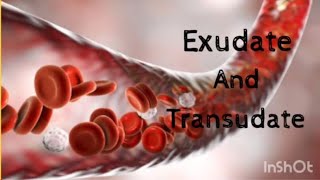 Exudate and Transudate  Basic Pathology [upl. by Kano]