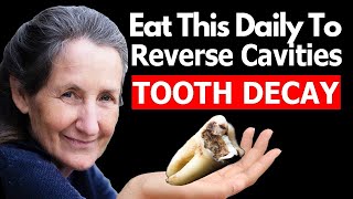 These Products Will KILL Cavity amp Heal Teeth  Barbara ONeill [upl. by Ubald]