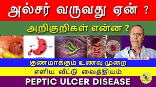 PEPTIC ULCER  SYMPTOMS CAUSES AND TREATMENT IN TAMIL FOODS TO CURE ULCER வயிற்றுப்புண் [upl. by Assili]