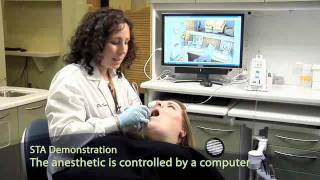 Single Tooth Anesthesia STA System  Pain Free Dentistry [upl. by Uy]