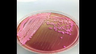 Klebsiella 1 S0125 Microbiology MCQs [upl. by Memberg454]