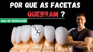 POR QUE AS FACETAS QUEBRAM [upl. by Annoynek]