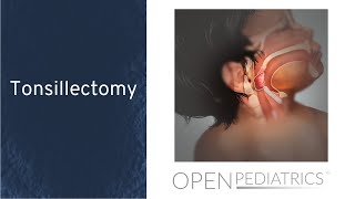 Tonsillectomy  OPENPediatrics [upl. by Imuy]