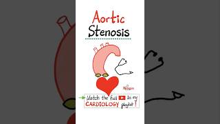 Aortic Stenosis AS  Valvular Heart Disease VHDscience doctor nurse cardio mbbs nclex [upl. by Nniuqal282]