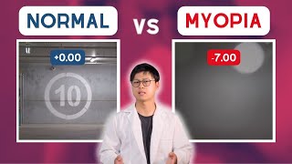 MYOPIA vs normal vision POV [upl. by Oiramaj]