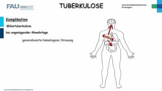 Pathologie ─ Tuberkulose [upl. by Bruell239]