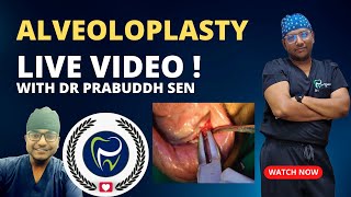 Dr Rudra Mohan  ALVEOLOPLASTY PROCEDURE LIVE  Preprosthetic Surgery  Smoothening Rough Jaw Bone [upl. by Enomis]