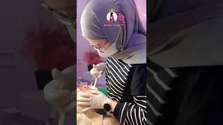 GRATIS BOTOX TREATMENT Setiap melakukan 3 treatment [upl. by Nodnal496]