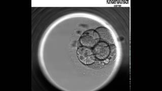 Die Embryo Entwicklung bis zur Blastozyste  Embryoskop [upl. by Eupheemia336]