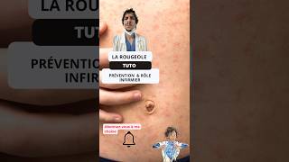 Comprendre et Prévenir la Rougeole  Guide pour les Infirmiers ide tutorial nurse measles tips [upl. by Merrile787]