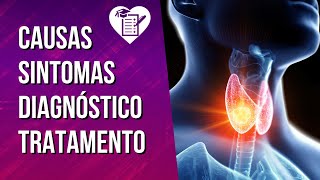 TIREOIDITE DE HASHIMOTO  Sintomas Fatores de Risco Diagnóstico e Tratamento [upl. by Aynat]