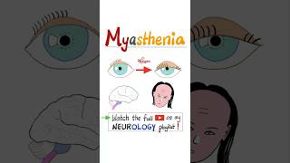 Myasthenia Gravis MG  Muscle Weakness Fatigue…science anatomy pathology health nurse mbbs [upl. by Zack]