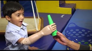 Prosthetic Myoelectric Arm Changes Childs Life [upl. by Yellah]