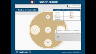 Tout savoir et comprendre sur lantibiogramme → Version courte← [upl. by Reemas715]