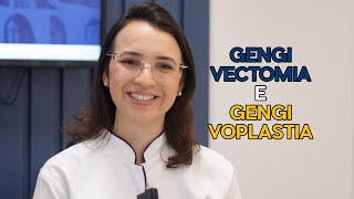 🦷 04 Você sabe o que é Gengivectomia e Gengivoplastia [upl. by Llertak108]