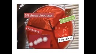 Blood agar showing alpha beta and gamma hemolysis  Use of blood agar [upl. by Naret927]