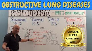 Obstructive Lung Diseases  COPD Chronic Bronchitis Asthma Bronchiectasis amp Emphysema🩺 [upl. by Gwendolen]