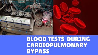 Blood Tests during Cardiopulmonary Bypass [upl. by Mohkos164]