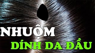 Cách xử lý Làm Gì Khi Thuốc Nhuộm Tóc Dính Vào Da  Thuốc Nhuộm Tóc [upl. by Nappie]