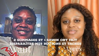 2 gommages et 1 savon pour faire disparaître vos taches et clarifier votre teint [upl. by Annawek747]