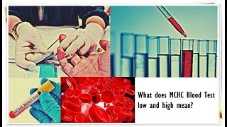 MCHC Blood Test  Low Normal High [upl. by Ubald]