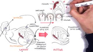 Obstetrics  Stages of Labour [upl. by Ikilisav804]