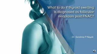 What to do if a thyroid swelling is diagnosed as a Follicular Neoplasm  Dr Sandeep Nayak [upl. by Dowdell]