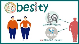 Obesity  Causes of Obesity  Diagnosis and Treatment of Obesity  Obesity treatment [upl. by Brahear]