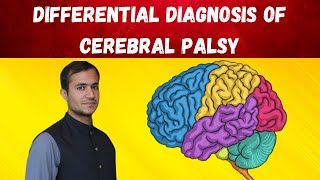 Cerebral palsy approach and differential diagnosis [upl. by Eillac807]