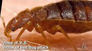 When the bed bug bitesOne Womans Story [upl. by Eeraj653]