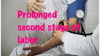 Medical Video Lecture OBGYN Prolonged second stage Of labor labour pregnancy [upl. by Auerbach]