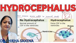 Hydrocephalus high CSF pressure communicating and noncommunicating Hydrocephalus [upl. by Jessalyn]