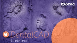 DentalCAD 32 Elefsina software release highlights [upl. by Akcire]