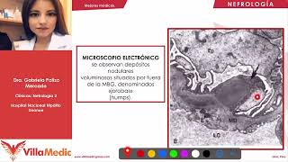 Glomerulonefritis postestreptocócica Villamedic  Clínicas 2021 [upl. by Enniotna520]