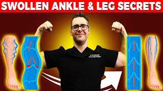 Lymphedema Treatment How to Get Rid of Swollen Feet Ankles amp Legs [upl. by Hoxsie984]