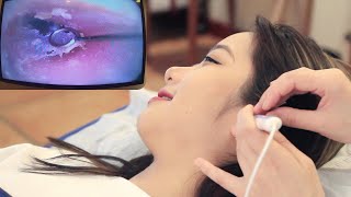 【ASMR】Experience the most professional visual ear cleaning Dig earwax relax ear massage [upl. by Alwyn]