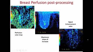 MRI PLANNNING TECHNIQUES ampTRICKS FOR IMAGING [upl. by Tyrus45]