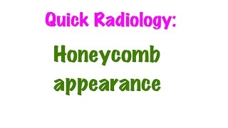 QUICK RADIOLOGY Honeycomb appearance on x ray [upl. by Tnafni]