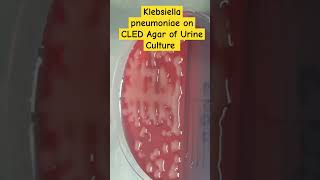 Klebsiella pneumoniae colony morphology on CLED of Urine Culture [upl. by Marola]