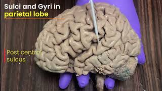 Brain Part 4 Sulci and Gyri in superolateral surface of brain [upl. by Eloise]