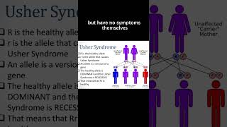 Inheritance of Usher syndrome [upl. by Ttennaej848]