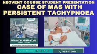 Case of MAS with persistent distress l Meconium aspiration [upl. by Meeka755]