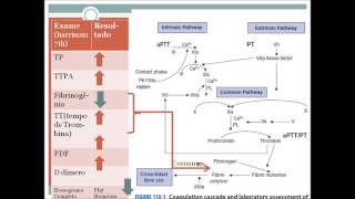 Emergência HUAP Coagulação Intravascular Disseminada CIVD [upl. by Neelyahs]