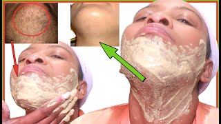 HOW I REMOVE FACIAL HAIR IN 5 MINUTES HAIR WILL NOT GROW BACK FAST CHIN LIPS AND JAWLINE [upl. by Valma602]