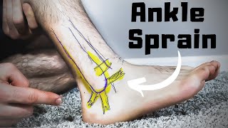 Twisted or Rolled Ankle Sprain Treatment FASTER Home Recovery Time [upl. by Deehsar254]