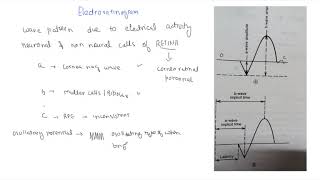 Electroretinogram [upl. by Osterhus]