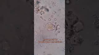 entamoeba histolytica pseudopodia locomotion through pseudopodia [upl. by Heber]