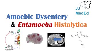 Amebiasis Amoebic Dysentery  Entamoeba histolytica Pathogenesis Signs amp Symptoms Treatment [upl. by Crutcher978]