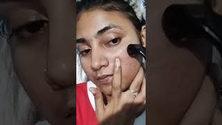 1mm derma roller detail video dermaroller pimpleproblem scarstreatment shortsvideo [upl. by Gale]