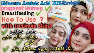 Skinoren Cream20Azelaic Acid Review How To Use Azelaic Acid With TretinoinSkinA Cream Retinoid [upl. by Demp]